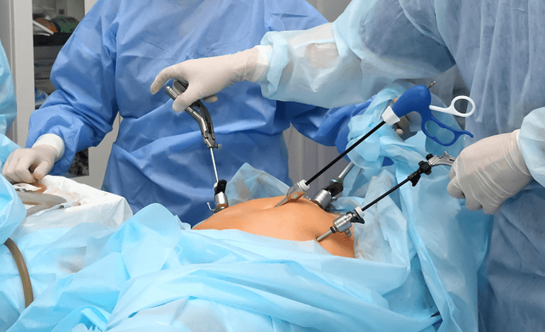 Cirugía laparoscópica ofrecida por Ginecólogos en CDMX - Especialista en Ginecología y Obstetricia